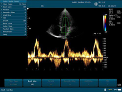 Аппарат УЗИ Edan U50 (для гинекологии, стандартный)