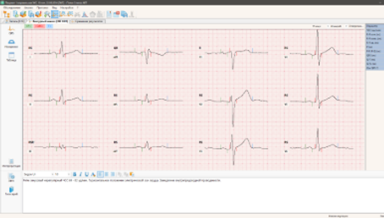 ПОЛИ-СПЕКТР-8/Е