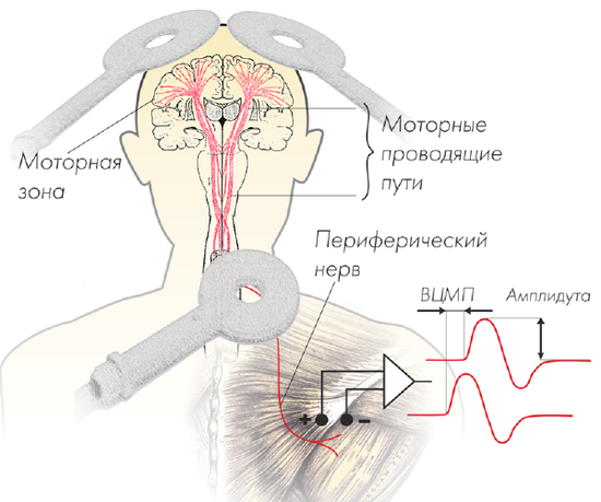 NEURO-МSX ДИАГНОСТИЧЕСКИЙ