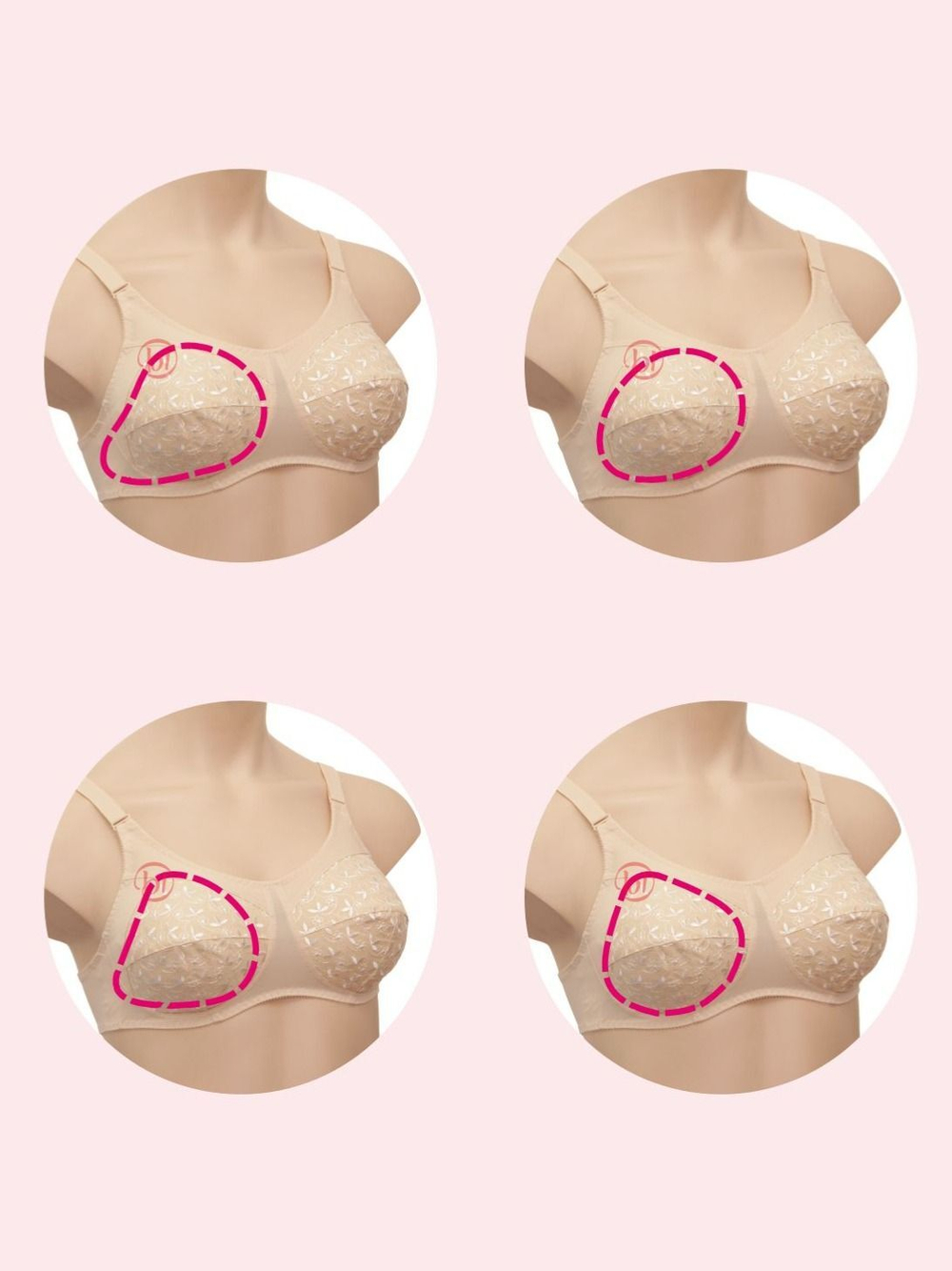 Бюстгальтер для фиксации экзопротеза Valeria ЛФ07 бежевый 80