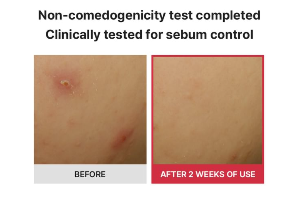 Очищающий, осветляющий, порысужающий тонер с гликолевой кислотой SKIN&LAB Glycolic Acid x Vitamin C Calming Toner, 180мл