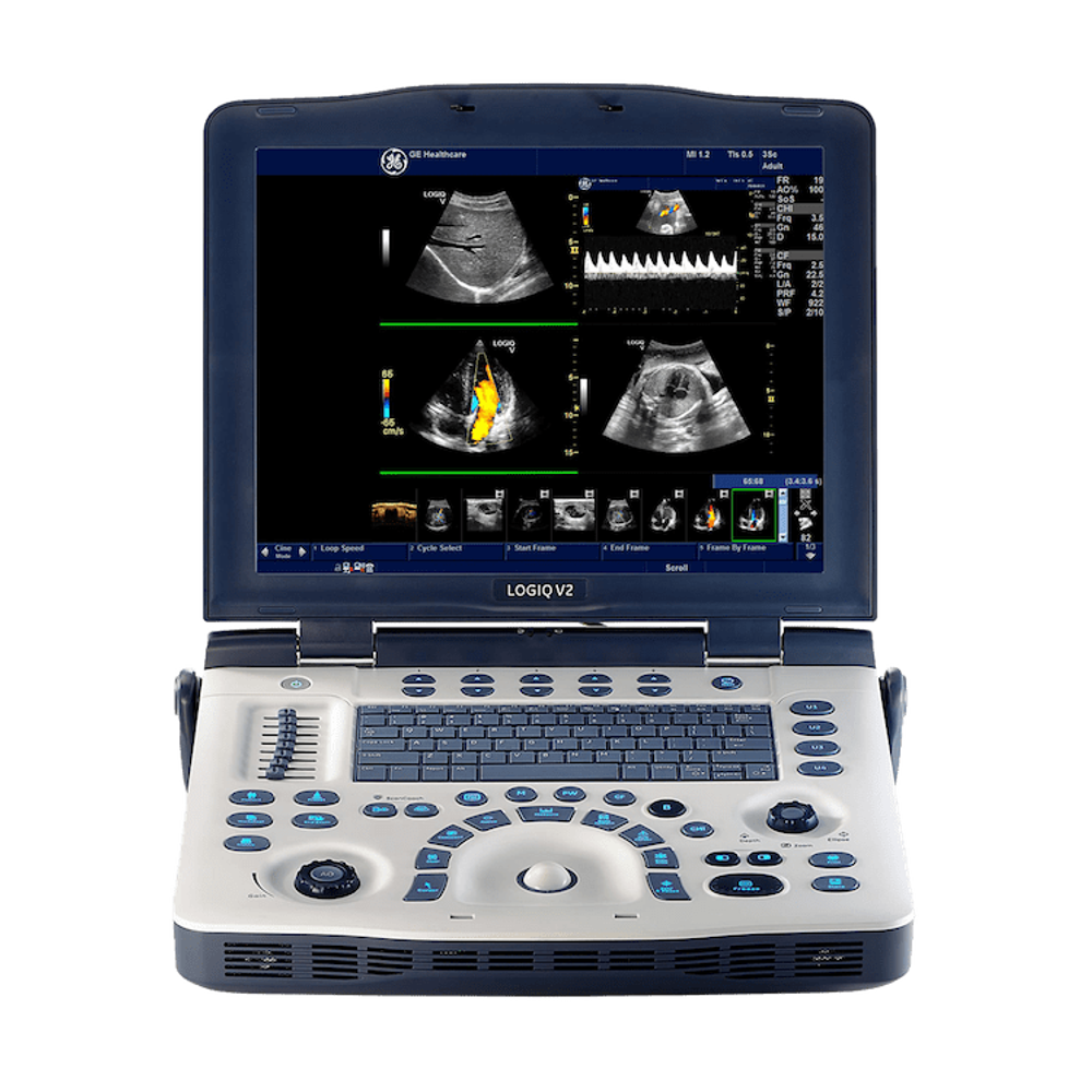 Ультразвуковой аппарат GE Healthcare LOGIQ V2