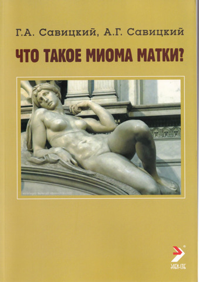 Что такое миома матки?