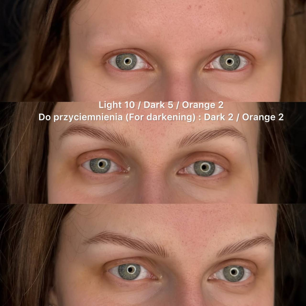 DARK (Brunet)
