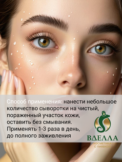 БАБЛ SOS сыворотка ранозаживляющая ВДЭЛЛА, 50мл