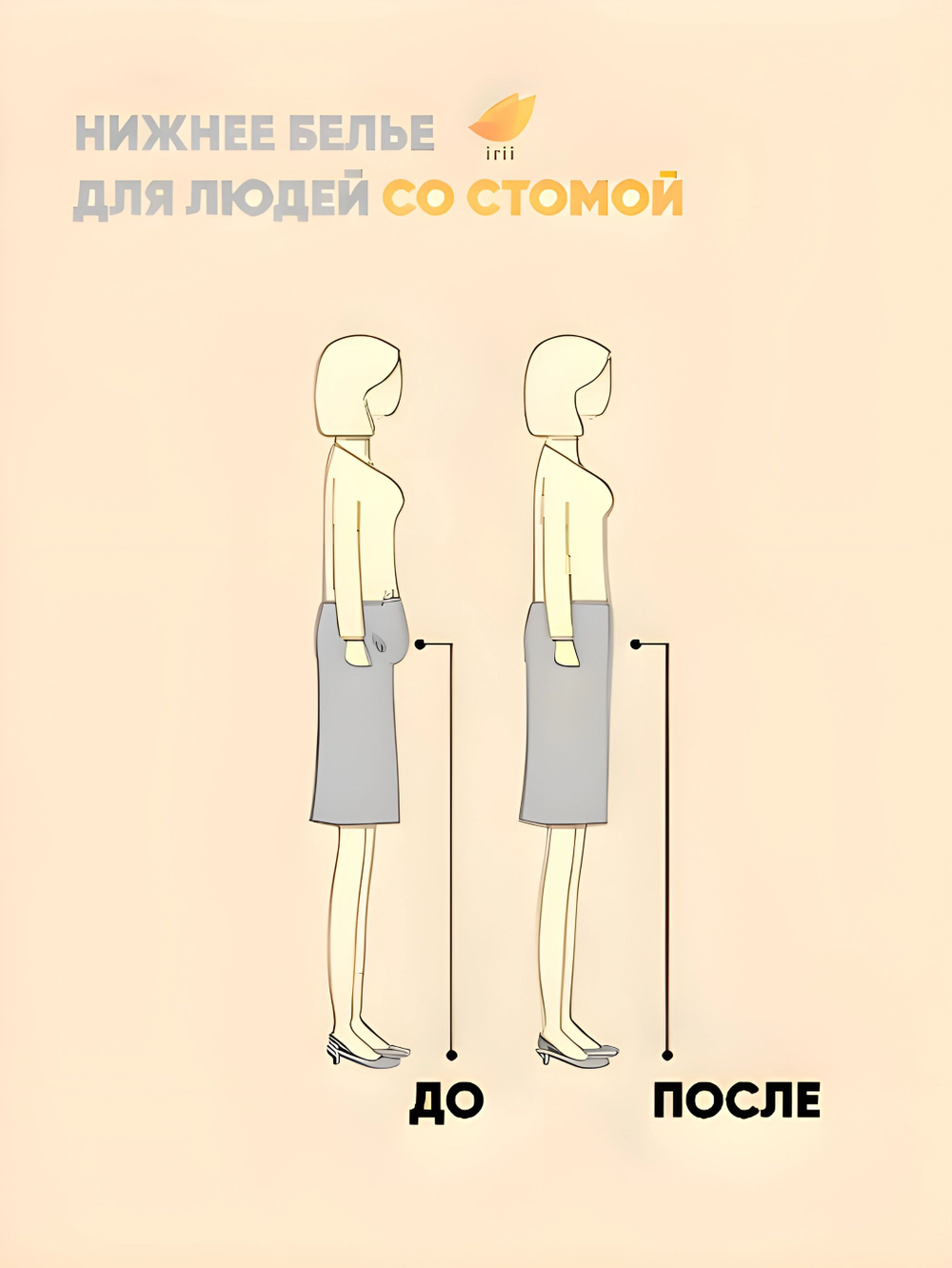 Irii Трусы женские для людей со стомой жемчуг, белые