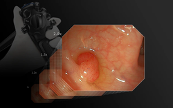 Видеоэндоскопическая система Aohua AQ-110