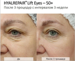 Hyalrepair Lift Eyes | ГК 12 мг/мл + Вит.С и Аминокислоты