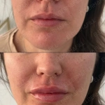 Deep French Kiss Eldermafill