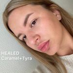 TYRA