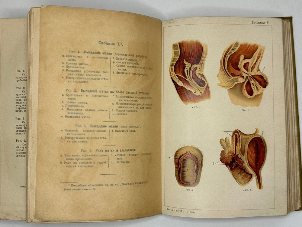 Платен М. Новый способ лечения. Лечение целебными силами природы. — Берлин: Изд. Просвещение, 1901