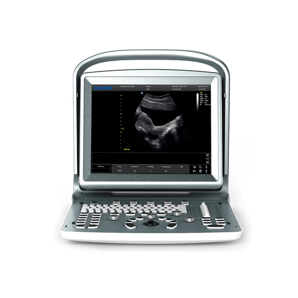 УЗИ аппарат CHISON ECO 5