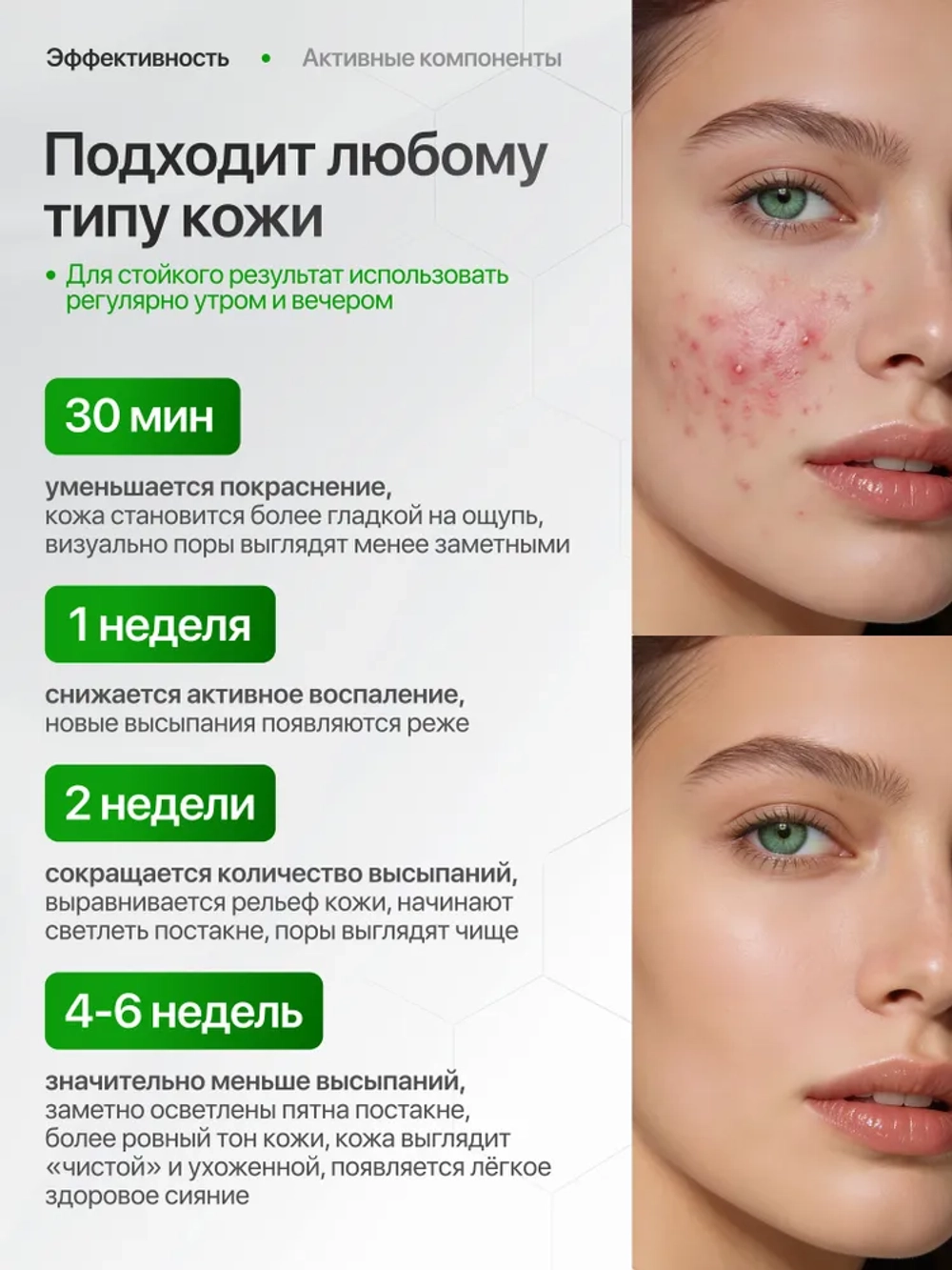 Del Monaco Крем для проблемной кожи лица от акне и прыщей с азелаиновой кислотой, 30 мл