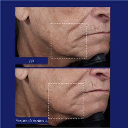 Obagi ELASTIderm® Lift Up & Sculpt Facial Moisturizer Увлажняющий крем для лифтинга и скульптурирования лица 50 мл