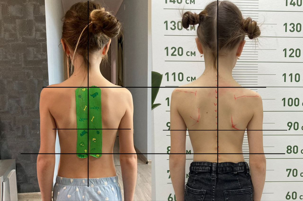 ДЕТИ: От 8 лет, Коррекция таза, коррекция ног, коррекция стопы, коррекция шеи, коррекция внутренних органов.
