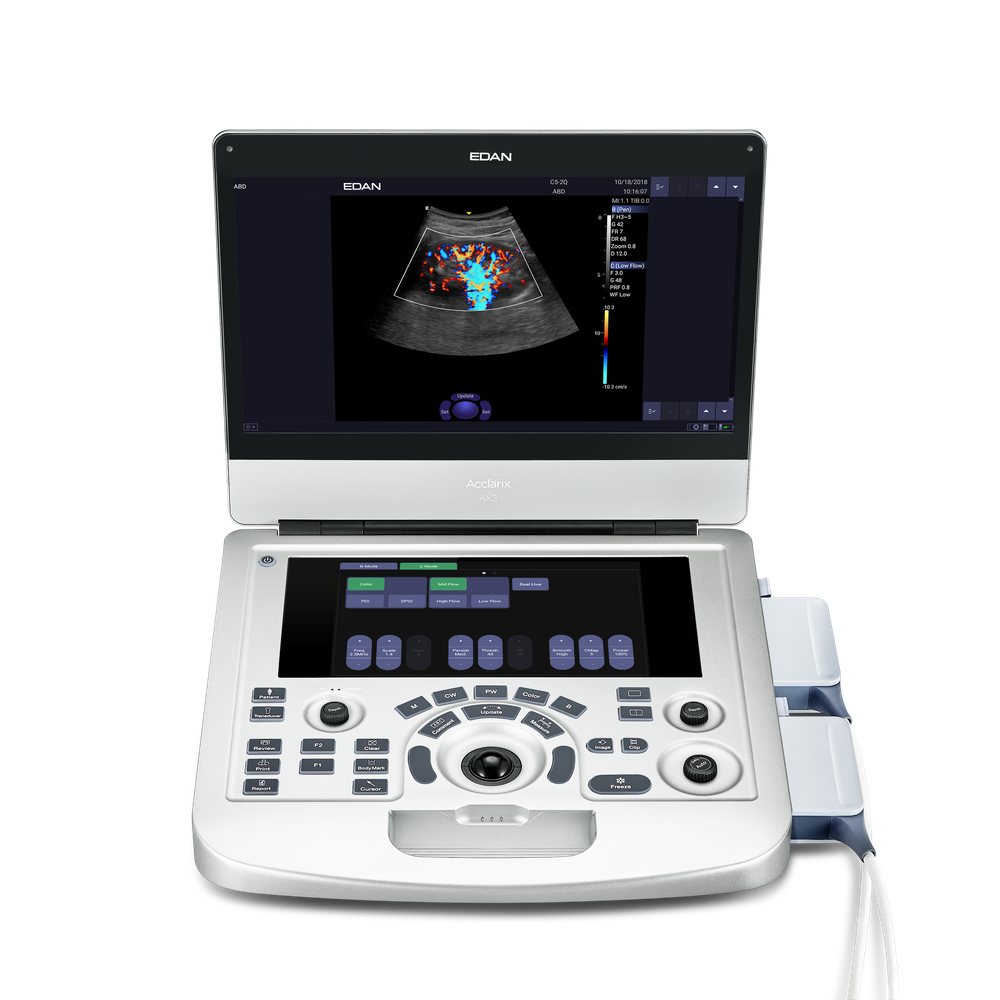 УЗИ аппарат Edan Acclarix AX3