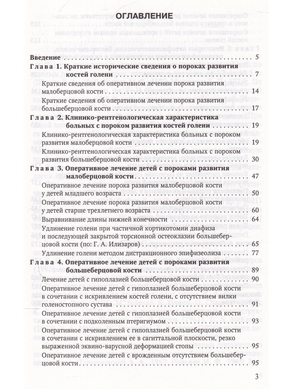 Врождённые пороки развития костей голени у детей