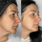 Rejusome | Сыворотка для омоложения кожи лица с экзосомами