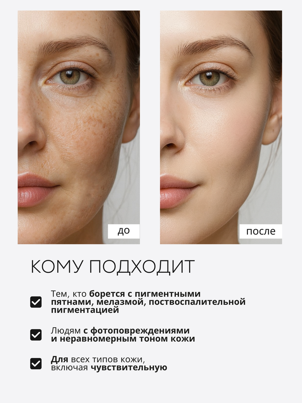 СЫВОРОТКА ОТ ГИПЕРПИГМЕНТАЦИИ LAURA ZACKARYA — 5% АЛЬФА-АРБУТИН И 3% ВИТАМИН C