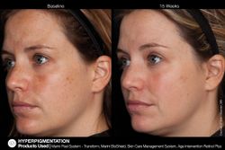 JAN MARINI AGE INTERVENTION RETINOL+ 0,5% Крем-акселератор с ретинолом 0,5% для борьбы с видимыми возрастными изменениями