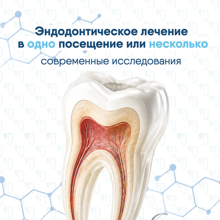 Эндодонтическое лечение в одно посещение или несколько: современные исследования