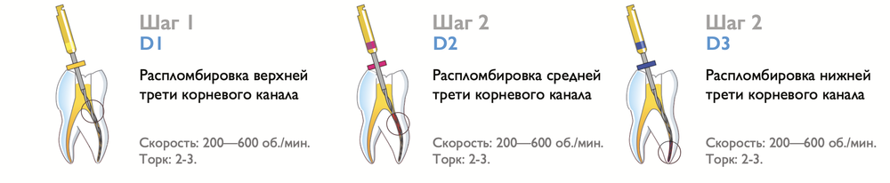 Файлы для детей Ротационные Эндо Файлы Мини SANI