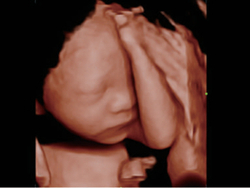 Аппарат УЗИ (сканер) Mindray DC-80 Exp