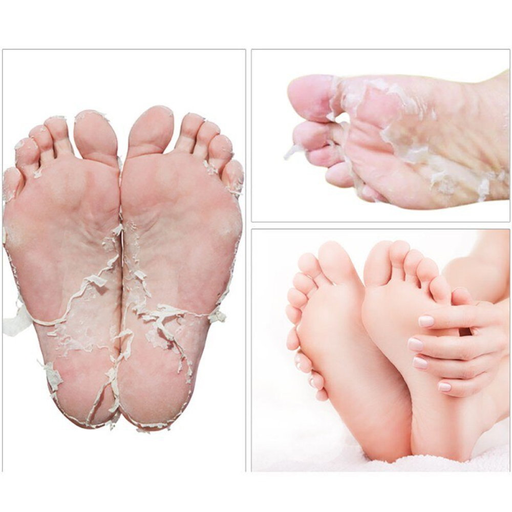 Eyenlip Baby Foot Peeling Mask носочки для педикюра