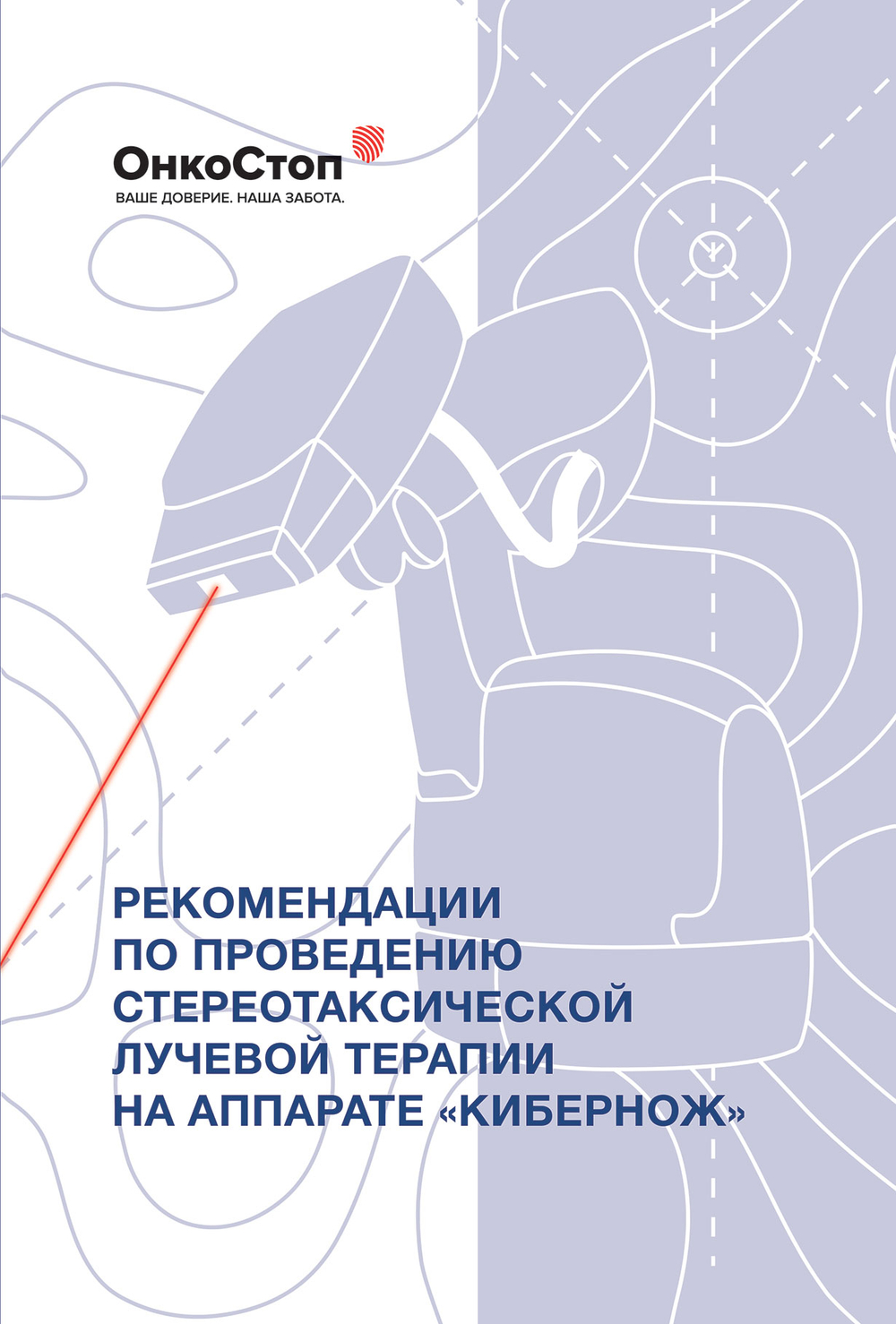 Рекомендации по проведению стереотаксической лучевой терапии на аппарате «КиберНож»