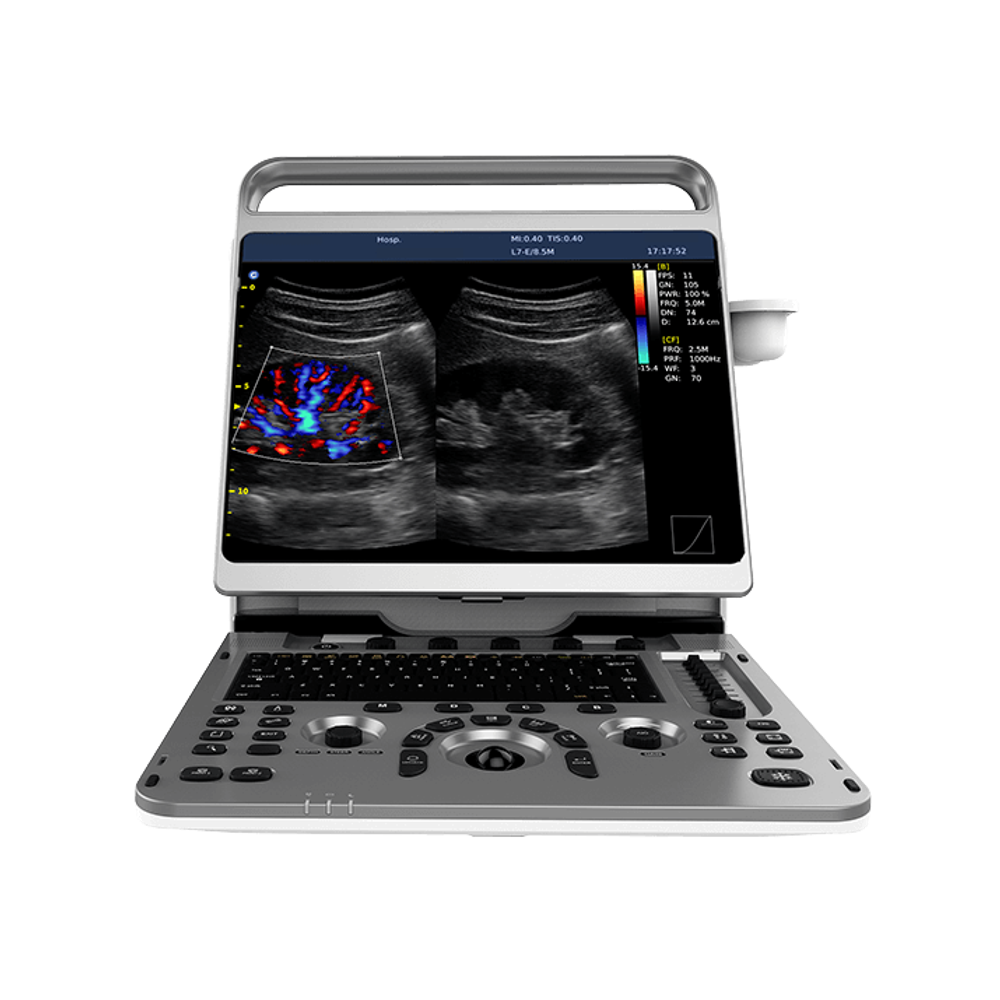 УЗИ аппарат CHISON EBit 50