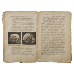 Таубер А. С. Огнестрельные повреждения при современном вооружении армий, 1903.