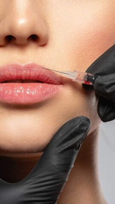 Cytosial Medium 1,1 мл (Франция)