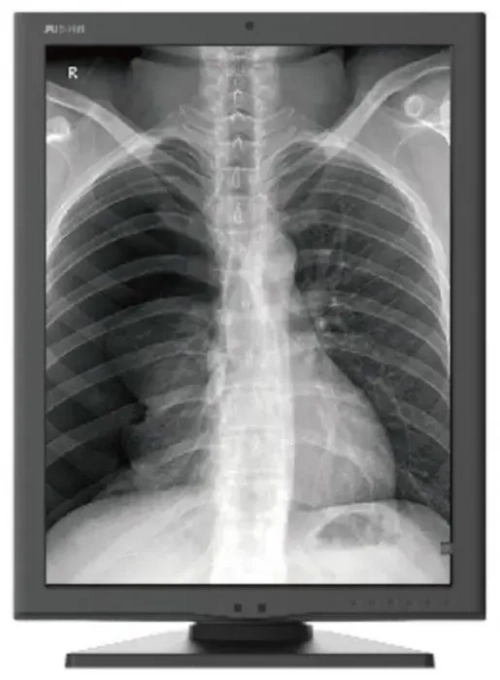 Монитор  Jusha JUSHA-M260G