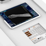 Палатный рентгеновский аппарат SG Healthcare JUMONG PG (40 кВт)