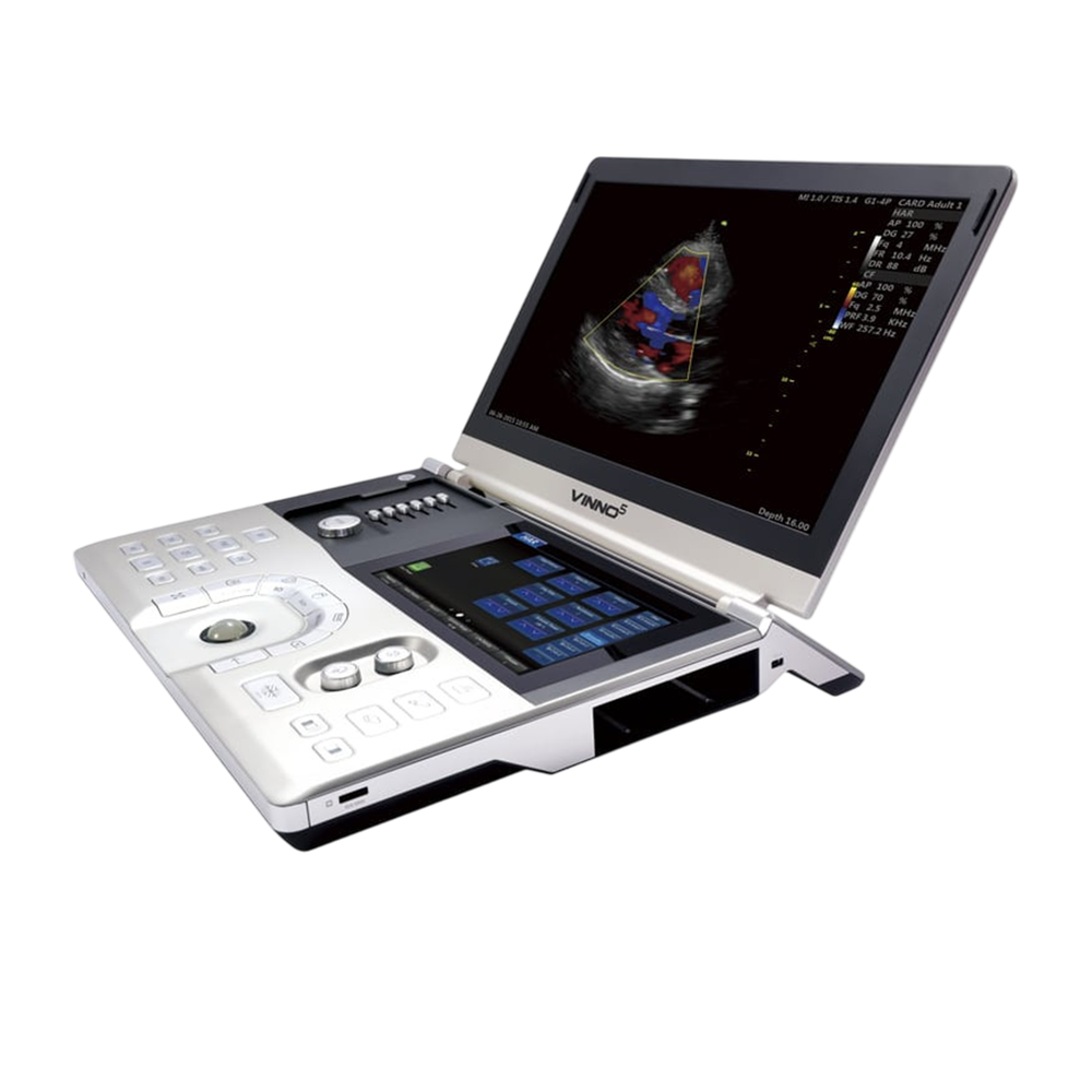 Портативный УЗИ аппарат VINNO 5
