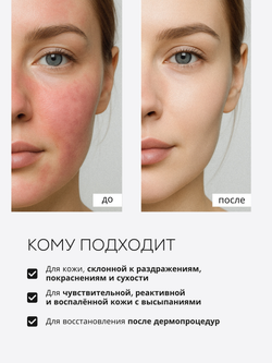 СЫВОРОТКА ДЛЯ ЧУВСТВИТЕЛЬНОЙ И РЕАКТИВНОЙ КОЖИ LAURA ZACKARYA — 2% ЭКТОИН И 2% СКВАЛАН