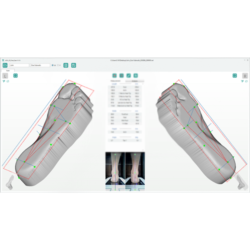 Ортопедический сканер ScanPod3D USOL X Floor