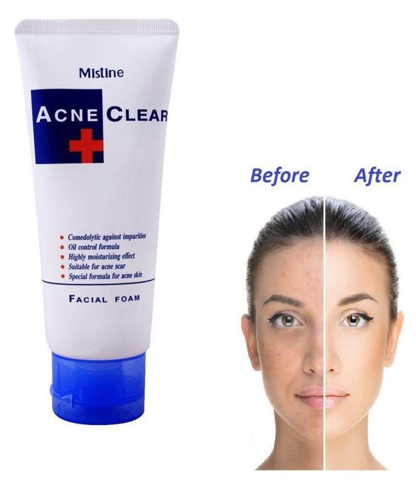 Пенка для умывания проблемной кожи MISTINE Acne Clear Facial Foam 85гр