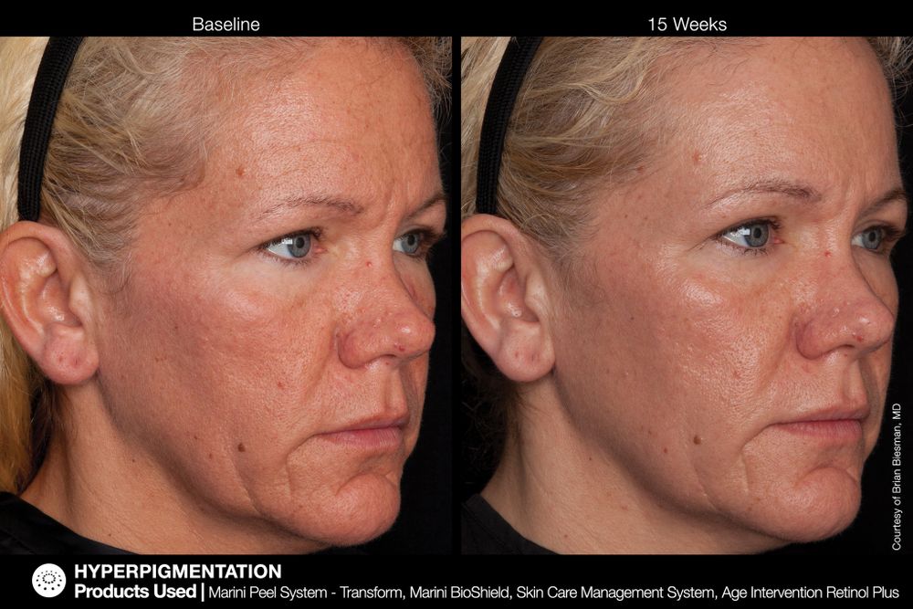 JAN MARINI AGE INTERVENTION RETINOL+ 0,5% Крем-акселератор с ретинолом 0,5% для борьбы с видимыми возрастными изменениями