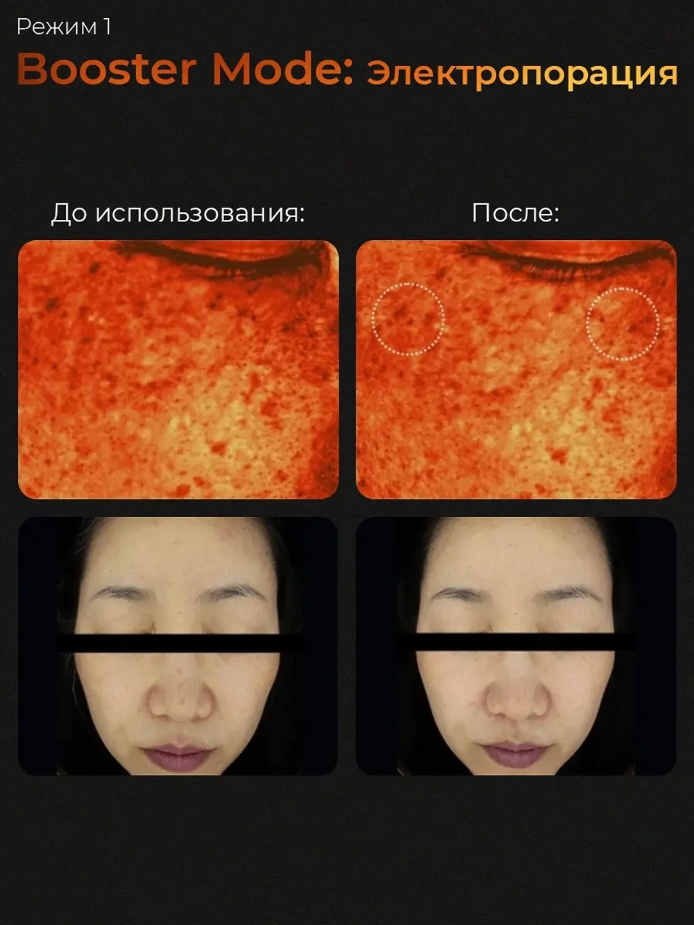 Medicube Микротоковый аппарат для лица 6-в-1 AGE-R Booster Pro Black