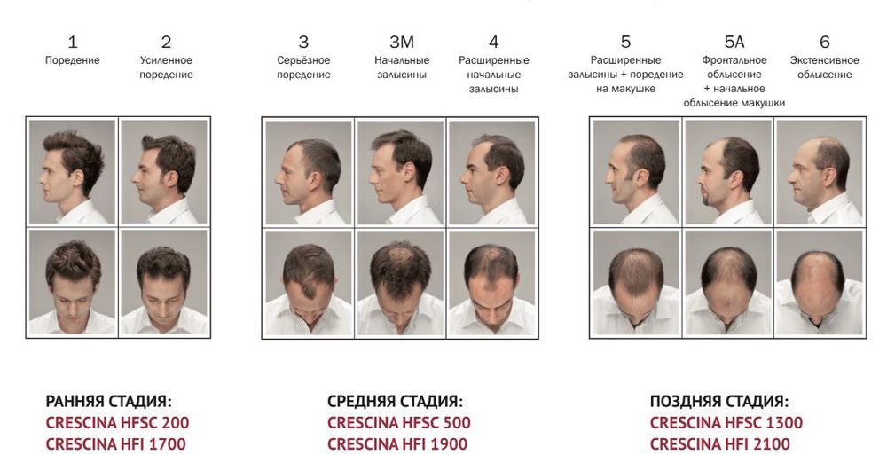 Crescina Transdermic HFSC 100% RE-GROWTH + ANTI-HAIR LOSS КОМПЛЕКС лосьон для возобновления роста волос + лосьон против выпадения волос для мужчин. Дозировка 1300 / 10+10 ампул
