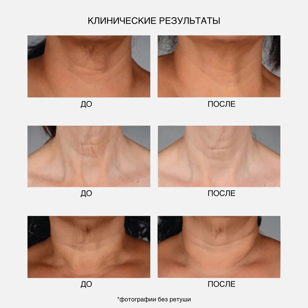 IS CLINICAL NeckPerfect Complex Интенсивный anti-age крем для шеи, 50 мл