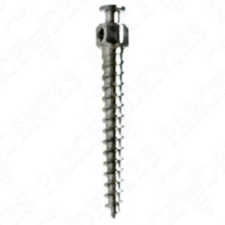 Ортовинты - микроимпланты для ортодонтии