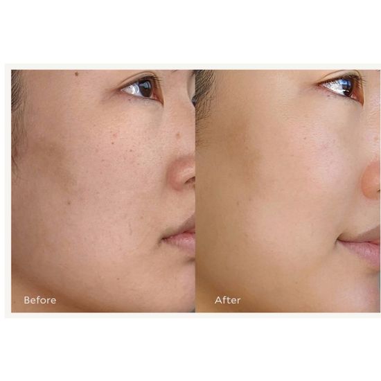 Tata Harper Resurfacing AHA + BHA Serum