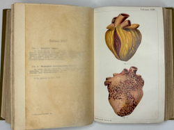 Платен М. Новый способ лечения. Лечение целебными силами природы. — Берлин: Изд. Просвещение, 1901