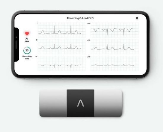 Аппарат ЭКГ AliveCor KardiaMobile 6L