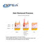 Диодный лазерный эпилятор EnTech 200W