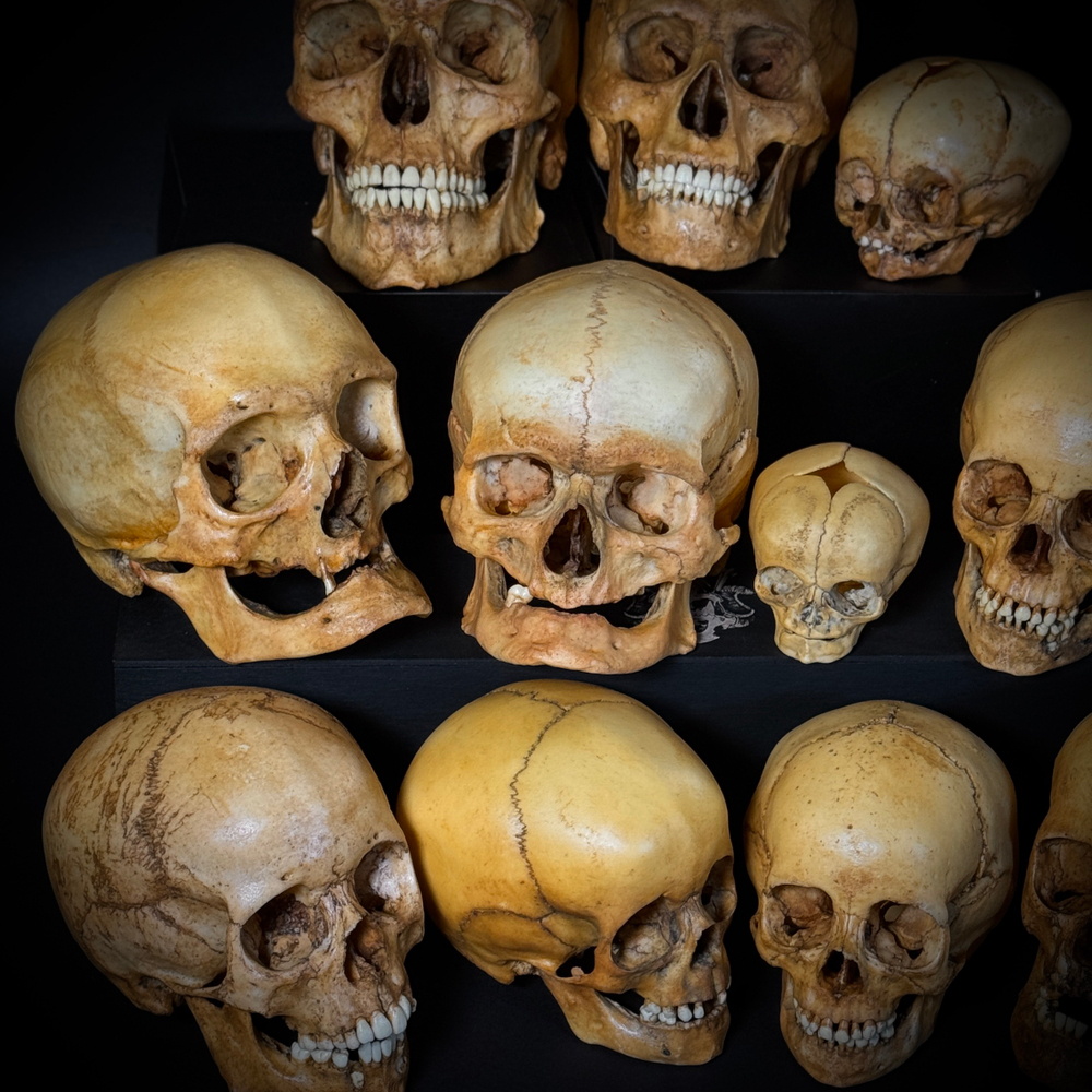 Набор «Череп человека» (анатомические модели)