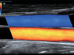 Аппарат УЗИ (сканер) Mindray DC-80 Exp