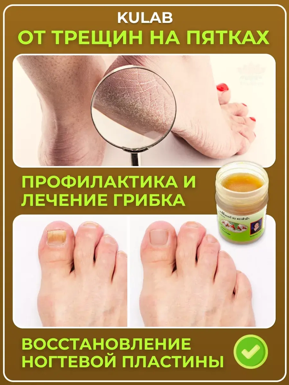 Тайская мазь от грибка ногтей, микоза и трещин на пятках